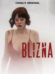 Blizna